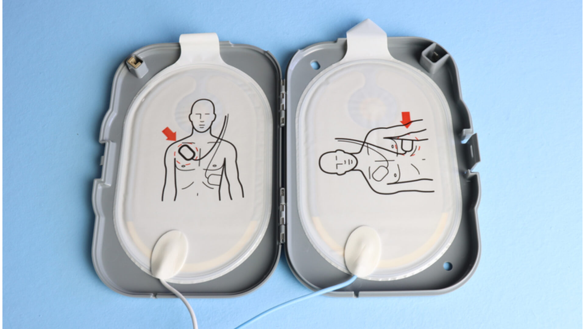 AED Pads Expiration Dates_ What You Need to Know About Replacing | AED Total Solution