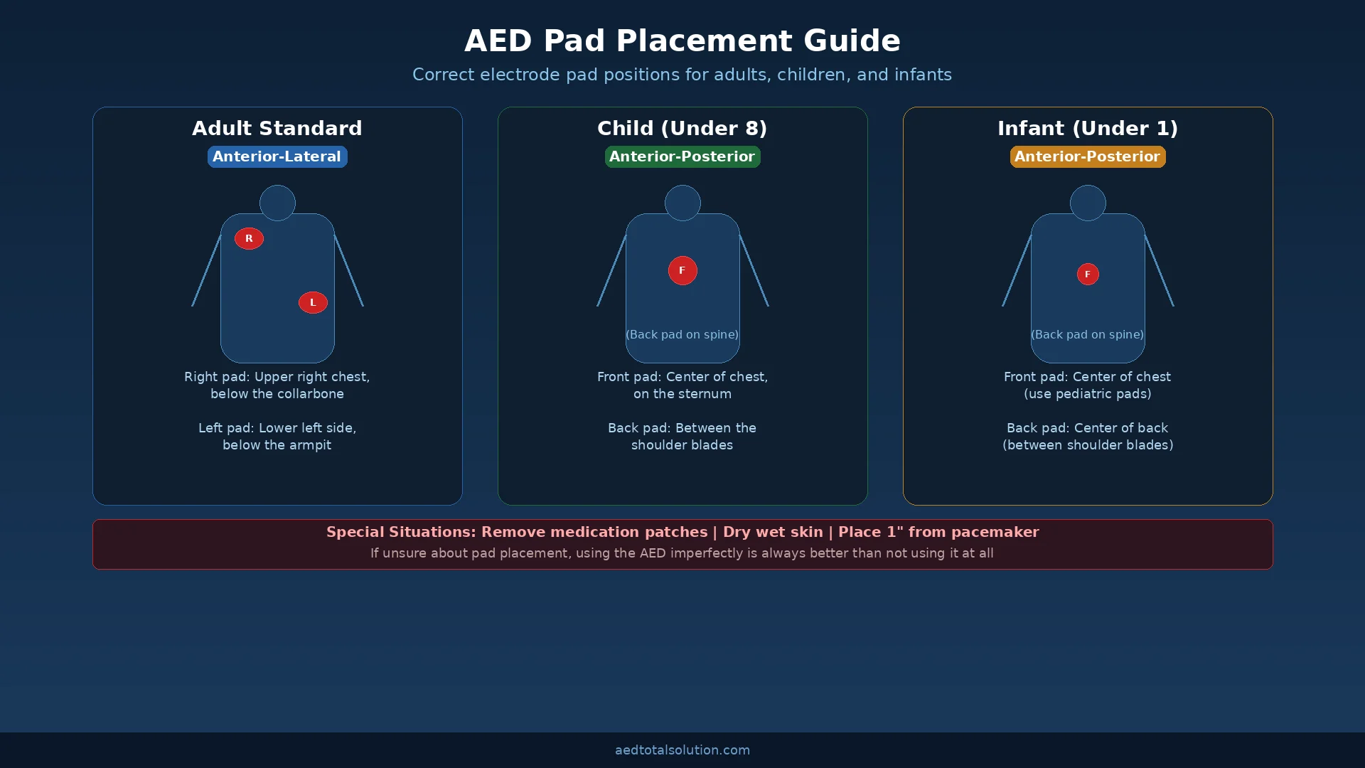 AED pad placement guide for adults children and infants